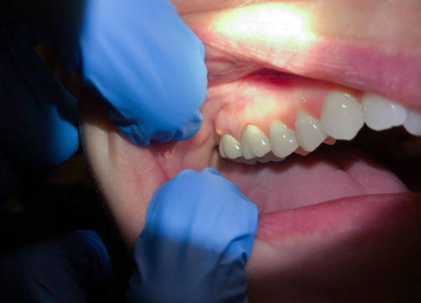 , OH Emergency Dentist Company